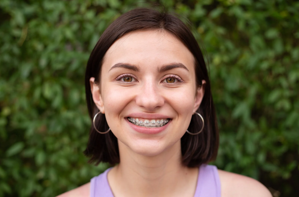 What Every Parent Should Know About Teen Orthodontics?