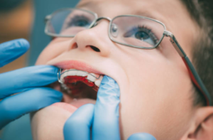 Affordable Braces in Buda