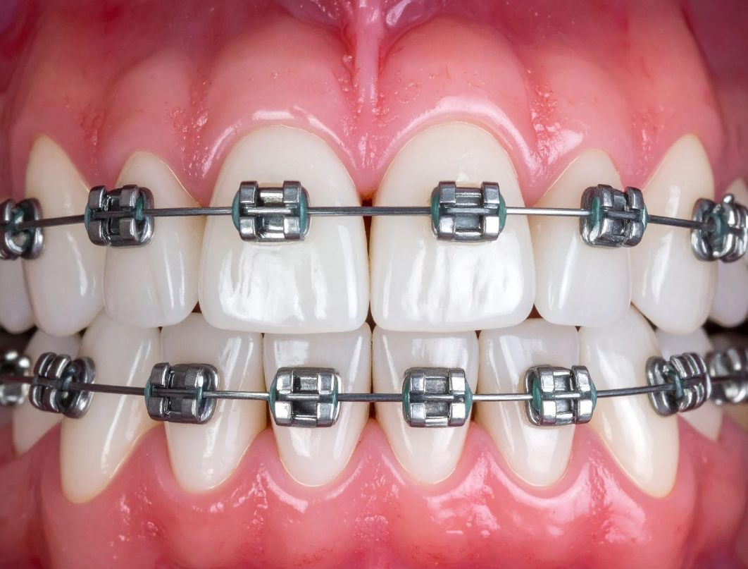 Which Area Has Better Access to Specialized Pediatric Orthodontists?