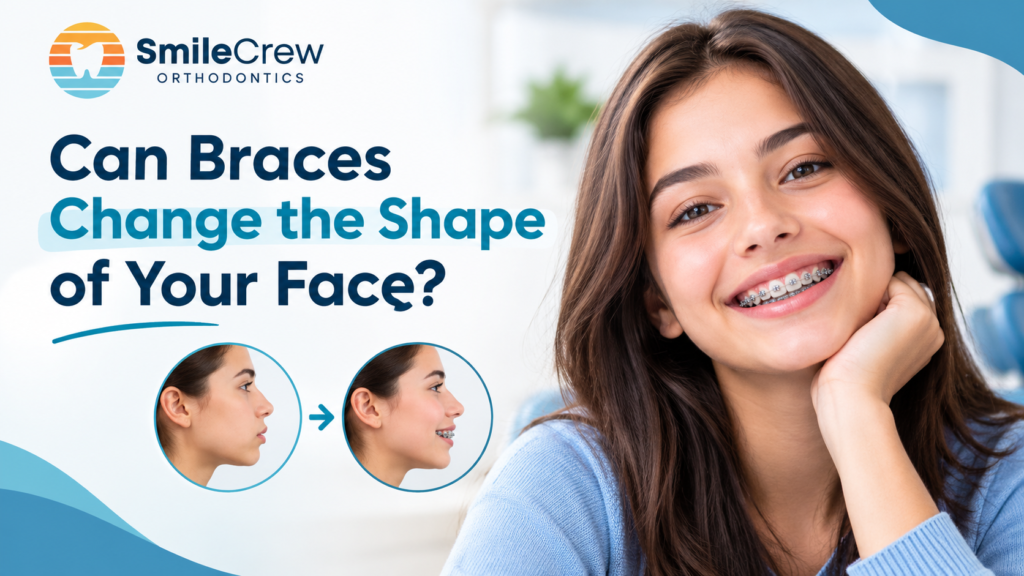 Can Braces Change the Shape of Your Face?
